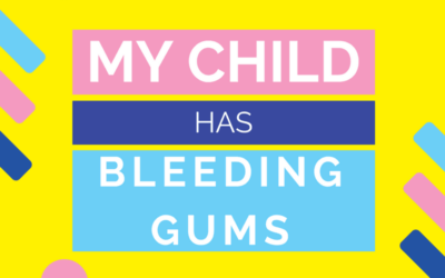 My Child Has Bleeding Gums – 4 [Common] Causes