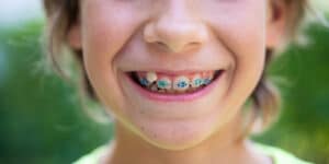 best age to get braces for a child