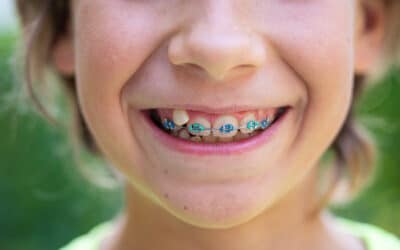 What Is The Best Age To Get Braces For A Child?
